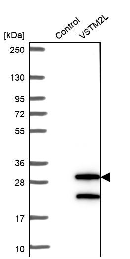 VSTM2L Antibody - BSA Free Western Blot: VSTM2L Antibody - BSA Free [NBP1-92577]