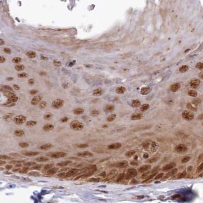 WAPL Antibody - BSA Free Immunohistochemistry-Paraffin: WAPL Antibody [NBP1-92579]