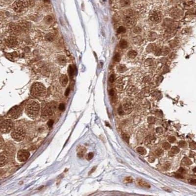 WAPL Antibody - BSA Free Immunohistochemistry-Paraffin: WAPL Antibody [NBP1-92579]