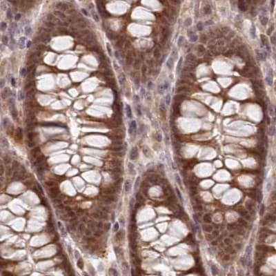 WAPL Antibody - BSA Free Immunohistochemistry-Paraffin: WAPL Antibody [NBP1-92579]
