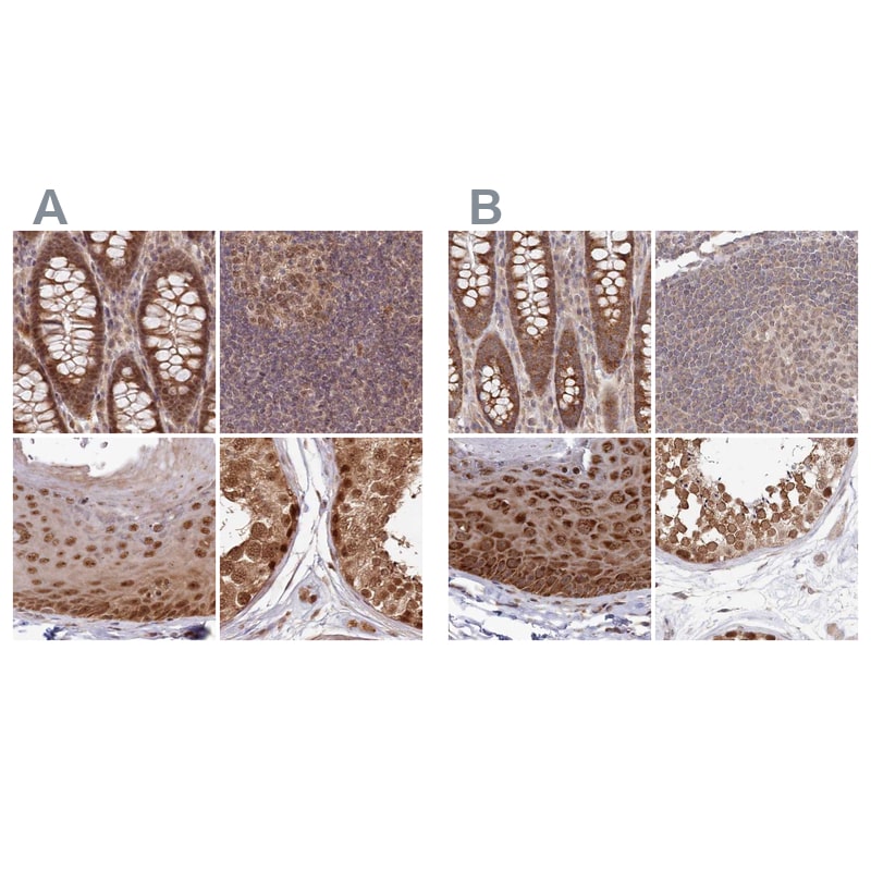 WAPL Antibody - BSA Free Immunohistochemistry-Paraffin: WAPL Antibody [NBP1-92579]