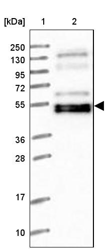 WAPL Antibody - BSA Free Western Blot: WAPL Antibody - BSA Free [NBP1-92579]