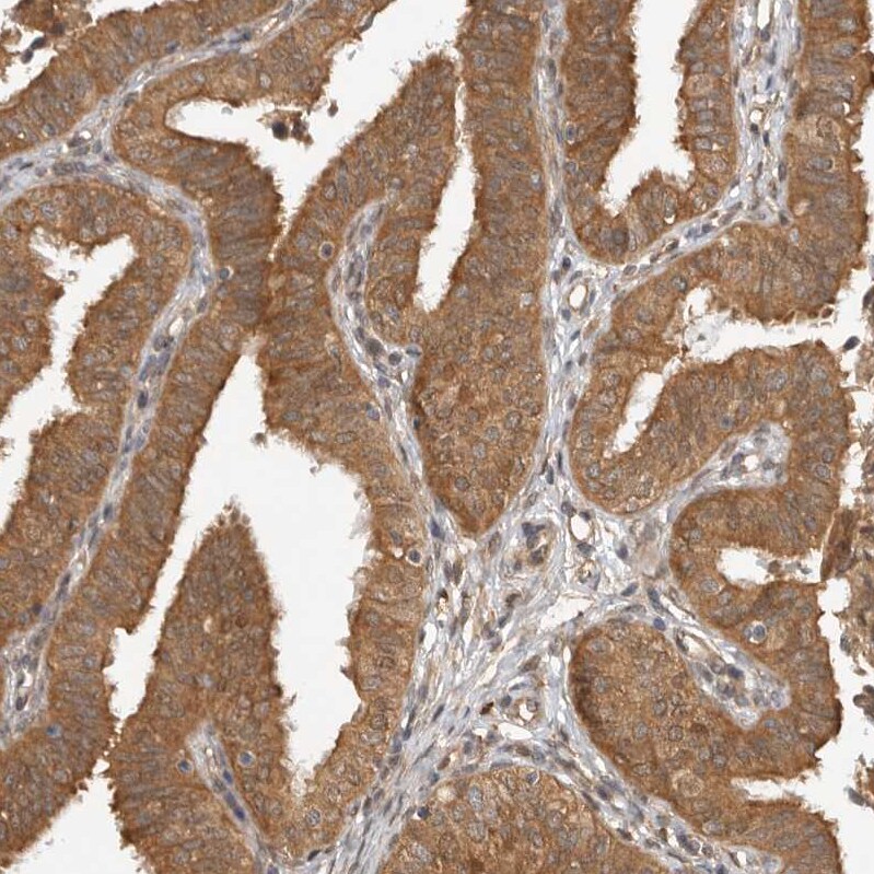 WDR42A Antibody - BSA Free Immunohistochemistry: WDR42A Antibody - BSA Free [NBP1-92582]