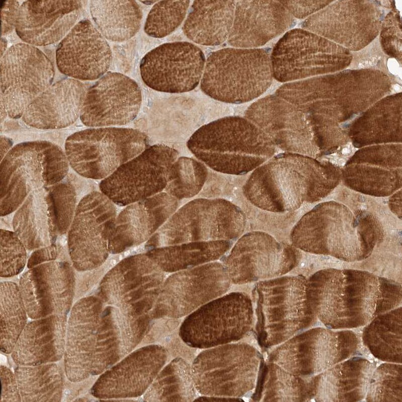 WDR42A Antibody - BSA Free Immunohistochemistry: WDR42A Antibody - BSA Free [NBP1-92582]