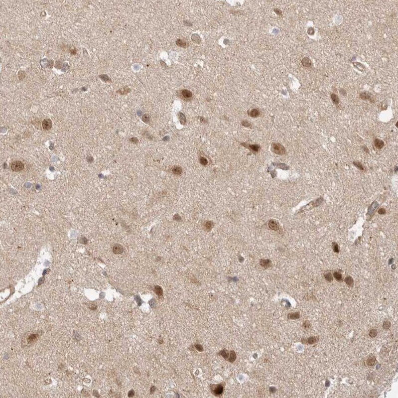 WDR42A Antibody - BSA Free Immunohistochemistry: WDR42A Antibody - BSA Free [NBP1-92582]