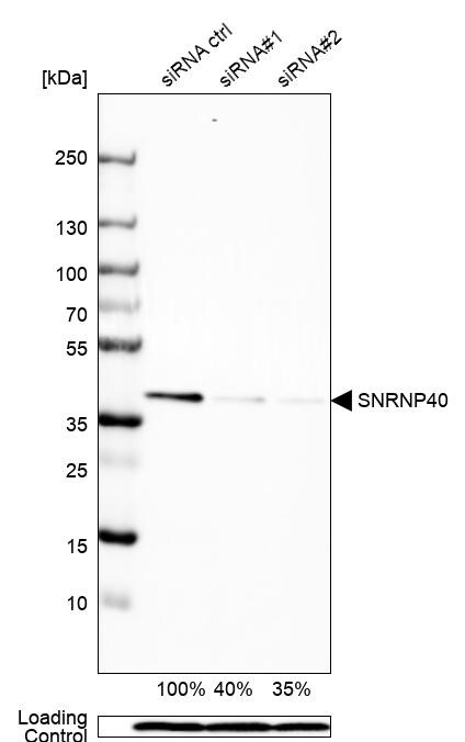 WDR57 Antibody - BSA Free Western Blot: WDR57 Antibody - BSA Free [NBP1-92585]