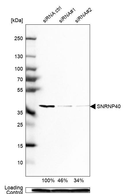WDR57 Antibody - BSA Free Western Blot: WDR57 Antibody - BSA Free [NBP1-92586]