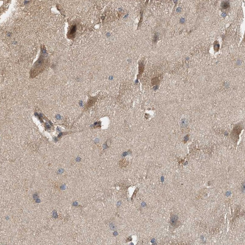 WDR68 Antibody - BSA Free Immunohistochemistry: WDR68 Antibody - BSA Free [NBP1-92589]