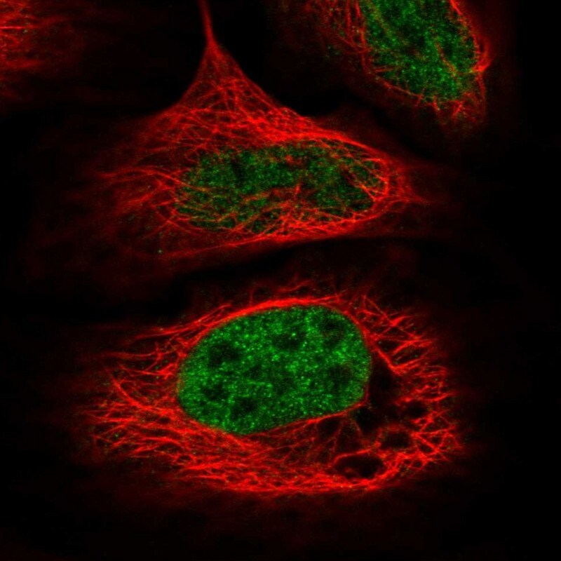 WDR92 Antibody - BSA Free Immunocytochemistry/ Immunofluorescence: WDR92 Antibody - BSA Free [NBP1-92594]