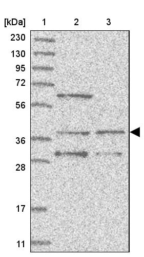 WDR92 Antibody - BSA Free Western Blot: WDR92 Antibody - BSA Free [NBP1-92594]