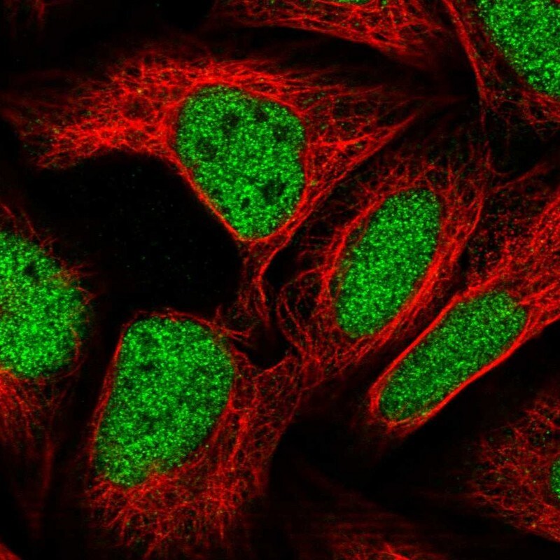 ZBTB22 Antibody - BSA Free Immunocytochemistry/ Immunofluorescence: ZBTB22 Antibody - BSA Free [NBP1-92603]