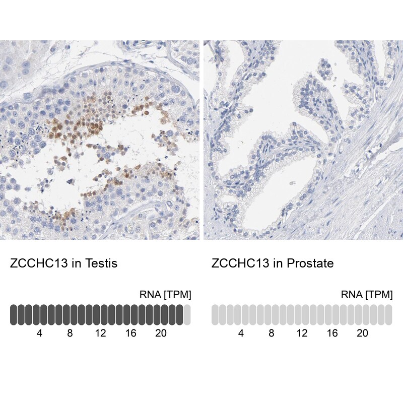 ZCCHC13 Antibody - BSA Free Immunohistochemistry: ZCCHC13 Antibody - BSA Free [NBP1-92604]