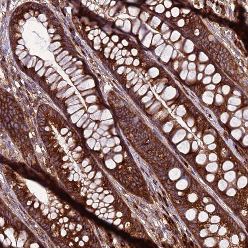 ZCCHV Antibody - BSA Free Immunohistochemistry: ZCCHV Antibody - BSA Free [NBP1-92607]