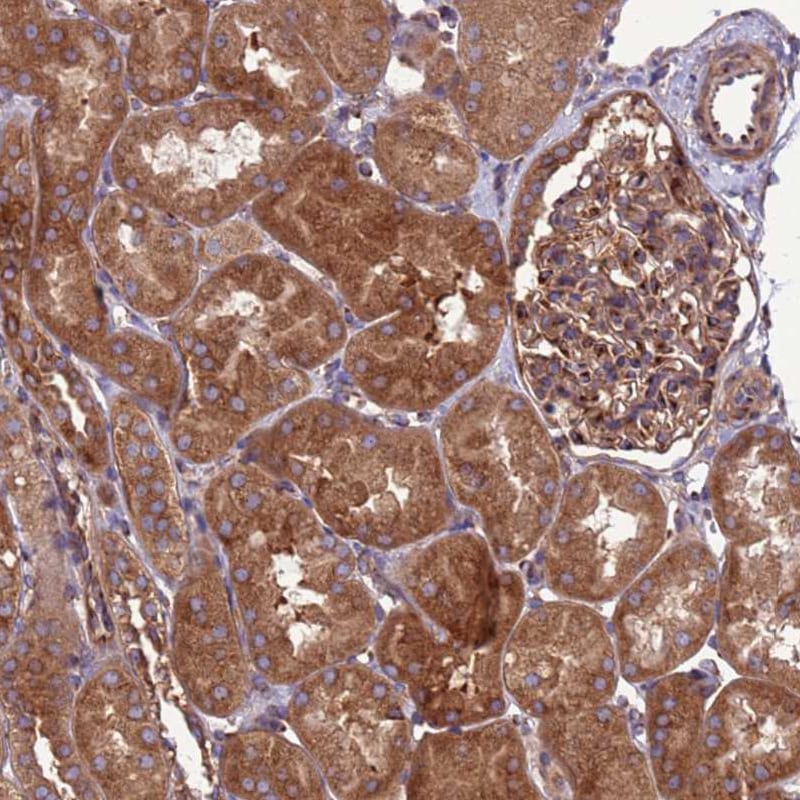 ZCCHV Antibody - BSA Free Immunohistochemistry: ZCCHV Antibody - BSA Free [NBP1-92607]