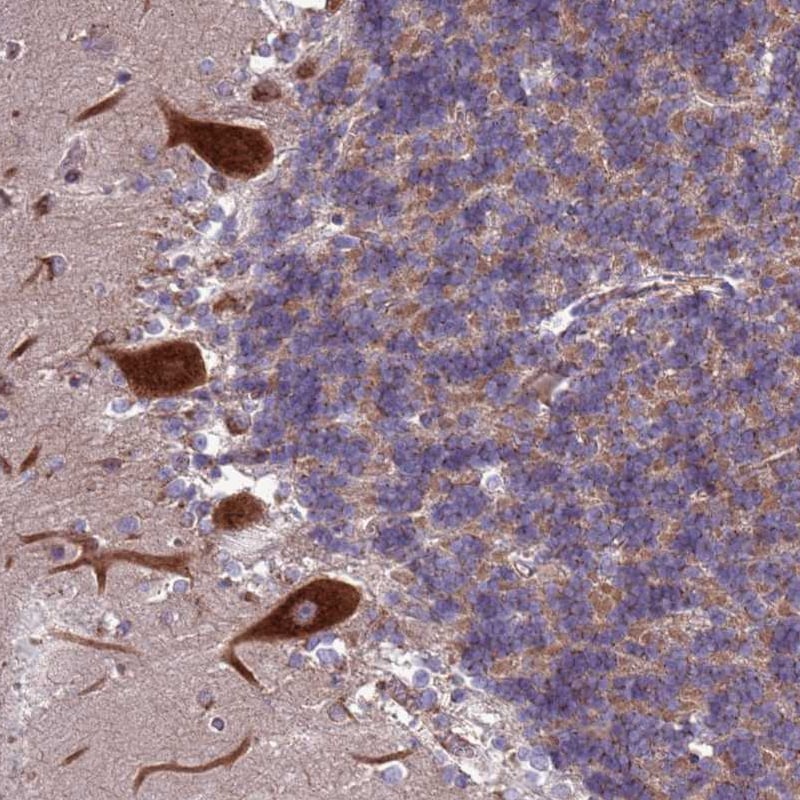 ZCCHV Antibody - BSA Free Immunohistochemistry: ZCCHV Antibody - BSA Free [NBP1-92607]