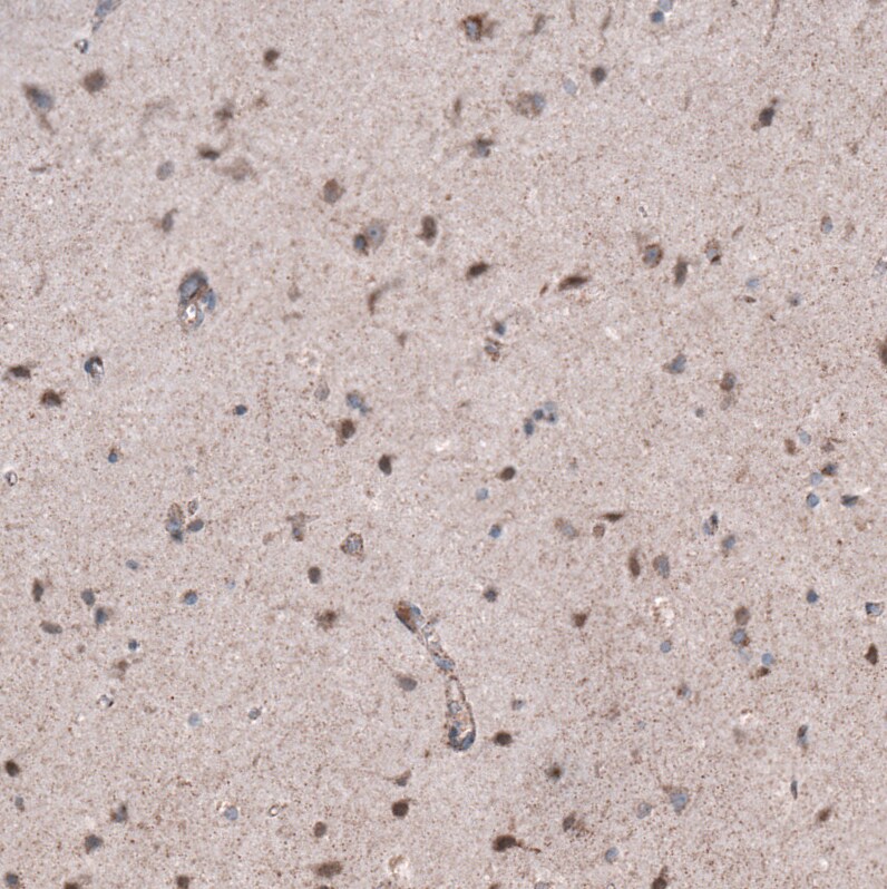 ZDHHC14 Antibody - BSA Free Immunohistochemistry: ZDHHC14 Antibody - BSA Free [NBP1-92608]