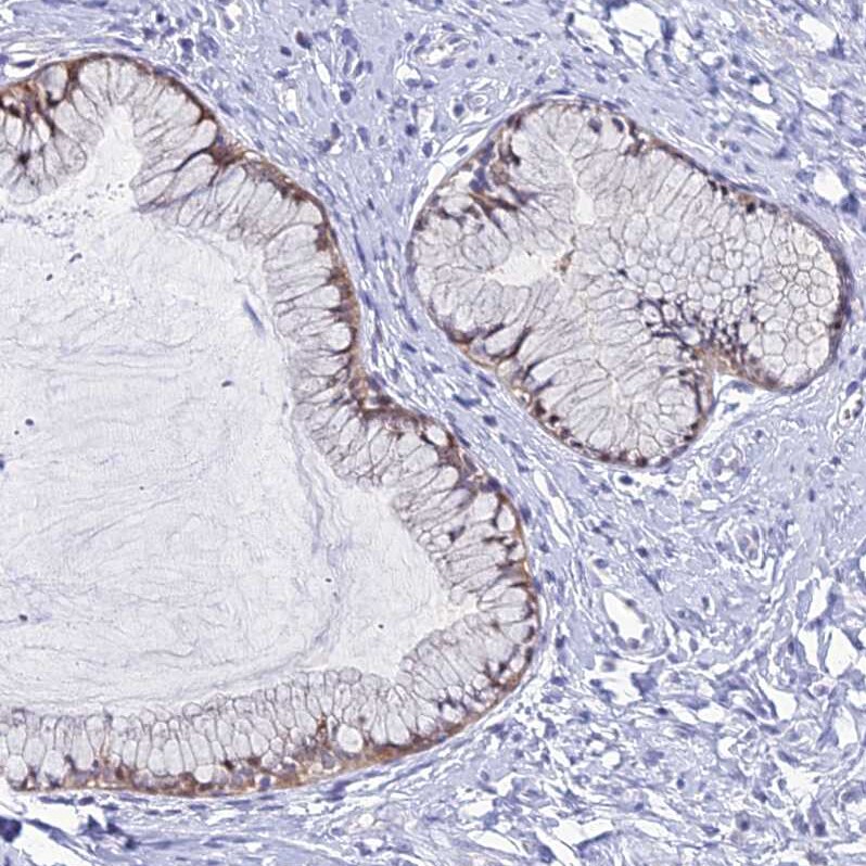 ZMIZ1/Zimp10 Antibody - BSA Free Immunohistochemistry: ZMIZ1/Zimp10 Antibody - BSA Free [NBP1-92610]