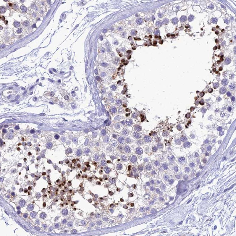 ZMIZ1/Zimp10 Antibody - BSA Free Immunohistochemistry: ZMIZ1/Zimp10 Antibody - BSA Free [NBP1-92610]