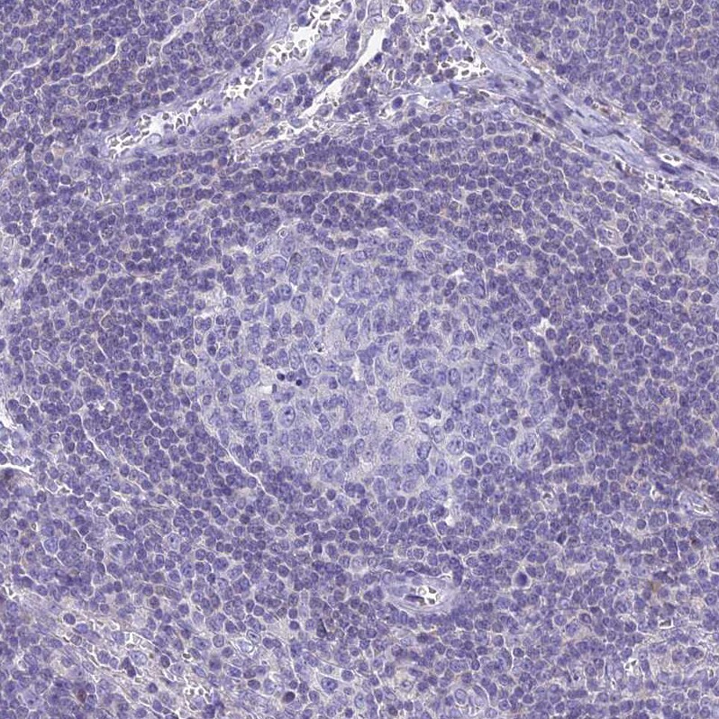 ZMIZ1/Zimp10 Antibody - BSA Free Immunohistochemistry: ZMIZ1/Zimp10 Antibody - BSA Free [NBP1-92610]