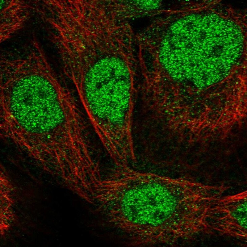 Zinc finger protein 180 Antibody - BSA Free Immunocytochemistry/ Immunofluorescence: Zinc finger protein 180 Antibody [NBP1-92613]