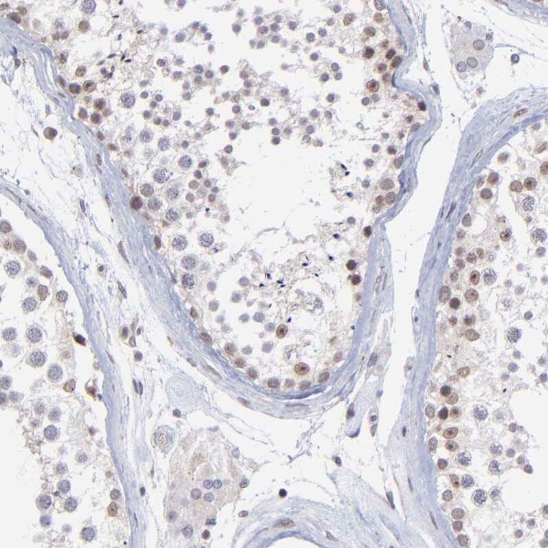 Zinc finger protein 773 Antibody - BSA Free Immunohistochemistry: Zinc finger protein 773 Antibody - BSA Free [NBP1-92616]