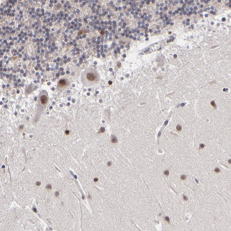 Zinc finger protein 773 Antibody - BSA Free Immunohistochemistry: Zinc finger protein 773 Antibody - BSA Free [NBP1-92616]
