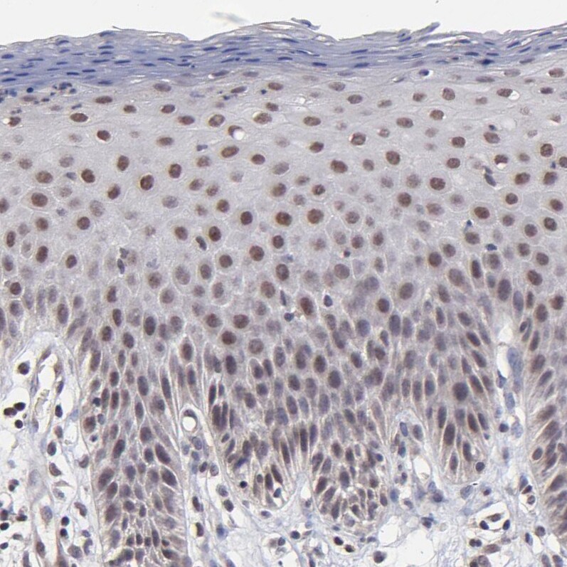 Zinc finger protein 773 Antibody - BSA Free Immunohistochemistry: Zinc finger protein 773 Antibody - BSA Free [NBP1-92616]