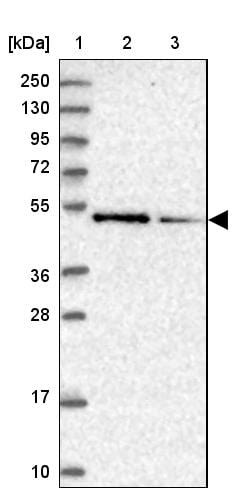 ZNF181 Antibody - BSA Free Western Blot: ZNF181 Antibody - BSA Free [NBP1-92618]