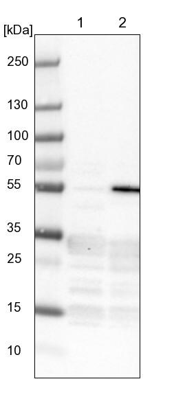 ZNF509 Antibody - BSA Free Western Blot: ZNF509 Antibody - BSA Free [NBP1-92628]