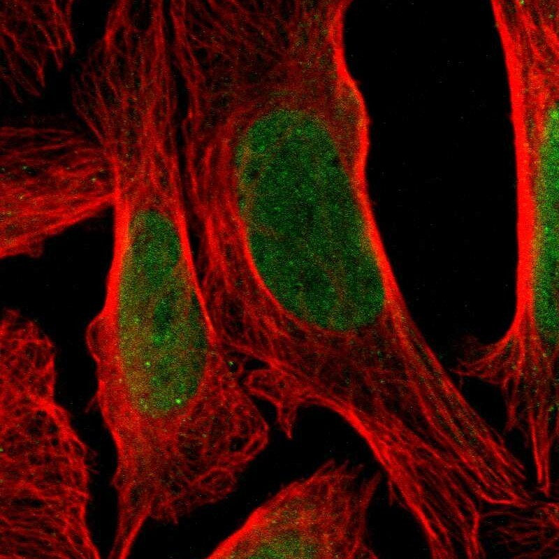 ZNF537 Antibody - BSA Free Immunocytochemistry/ Immunofluorescence: ZNF537 Antibody - BSA Free [NBP1-92629]