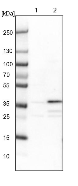 ZNF609 Antibody - BSA Free Western Blot: ZNF609 Antibody - BSA Free [NBP1-92634]