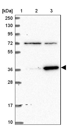 ZNF609 Antibody - BSA Free Western Blot: ZNF609 Antibody - BSA Free [NBP1-92634]