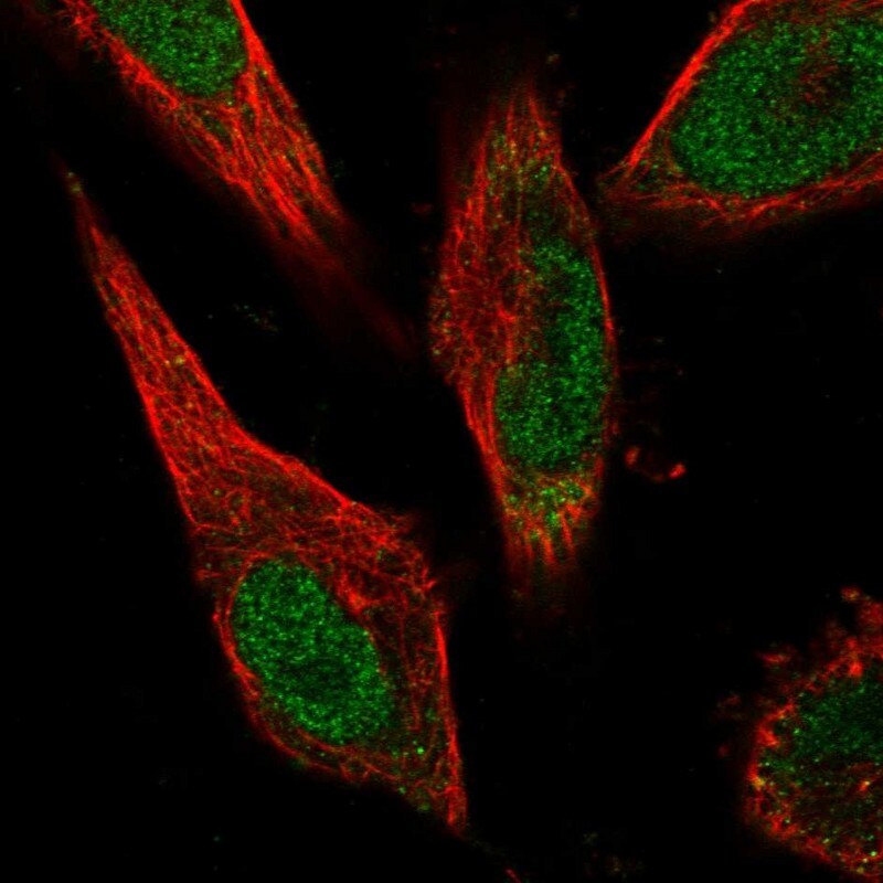 ZNF643 Antibody - BSA Free Immunocytochemistry/ Immunofluorescence: ZNF643 Antibody - BSA Free [NBP1-92639]