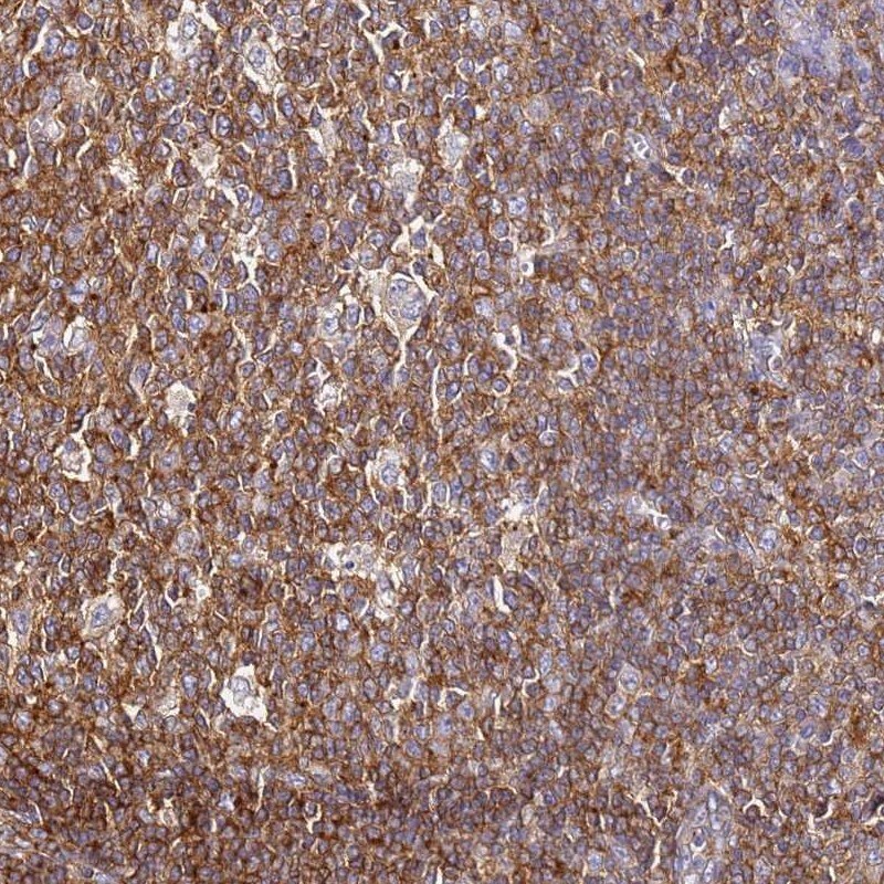 ZNF671 Antibody - BSA Free Immunohistochemistry: ZNF671 Antibody - BSA Free [NBP1-92641]