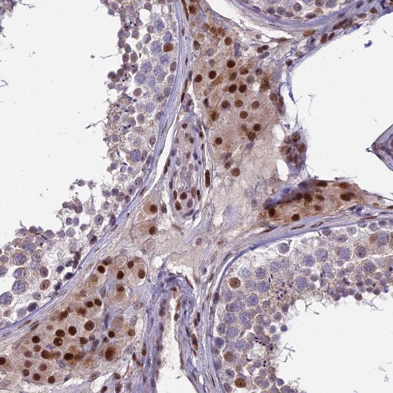 ZNF707 Antibody - BSA Free Immunohistochemistry: ZNF707 Antibody - BSA Free [NBP1-92642]