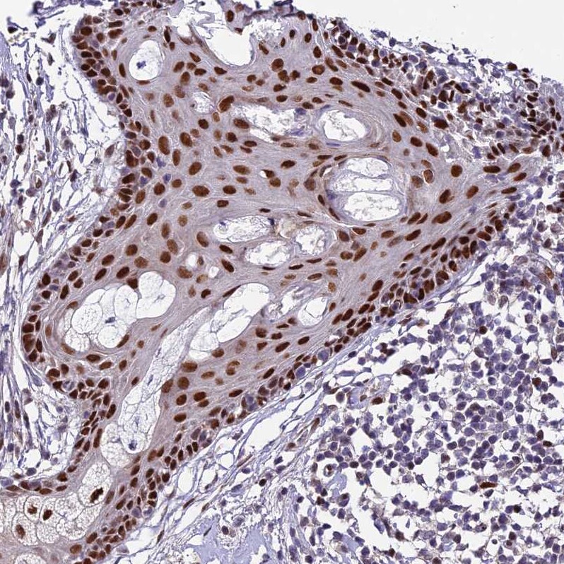 ZNF707 Antibody - BSA Free Immunohistochemistry: ZNF707 Antibody - BSA Free [NBP1-92642]