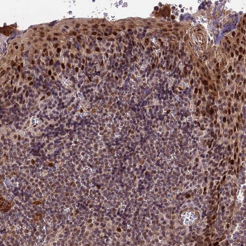 ZNF85 Antibody - BSA Free Immunohistochemistry: ZNF85 Antibody - BSA Free [NBP1-92645]