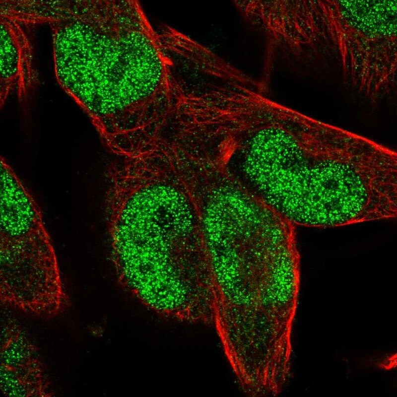 ZNF85 Antibody - BSA Free Immunocytochemistry/ Immunofluorescence: ZNF85 Antibody - BSA Free [NBP1-92645]