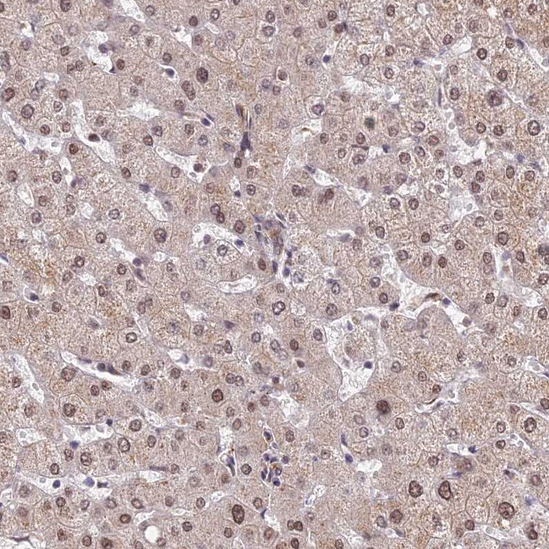 ZNF85 Antibody - BSA Free Immunohistochemistry: ZNF85 Antibody - BSA Free [NBP1-92645]