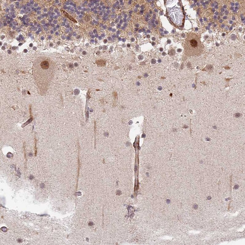 ZNF85 Antibody - BSA Free Immunohistochemistry: ZNF85 Antibody - BSA Free [NBP1-92645]