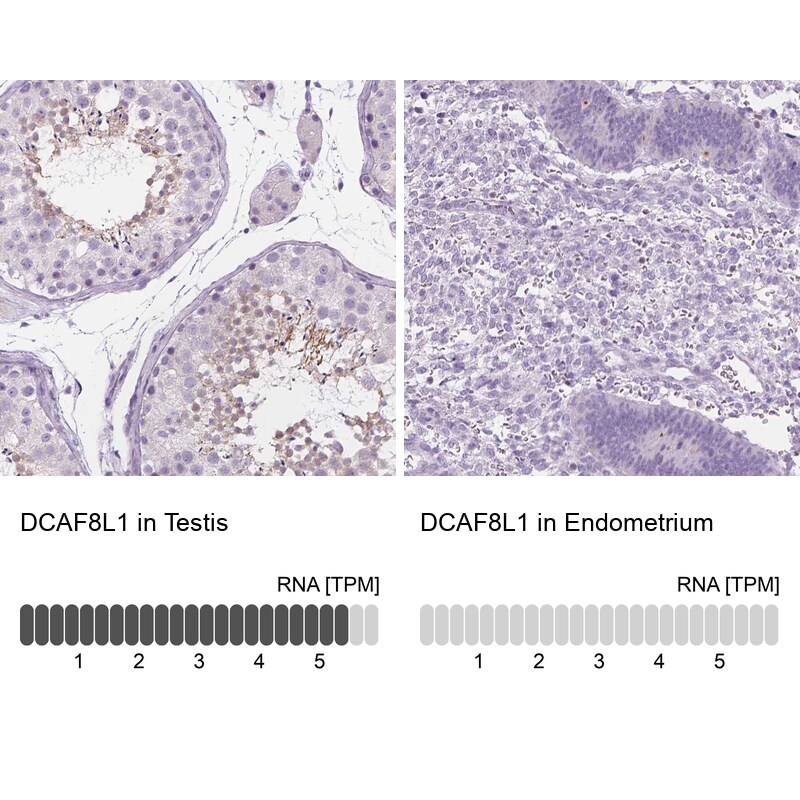 DCAF8L1 Antibody - BSA Free Immunohistochemistry: DCAF8L1 Antibody - BSA Free [NBP1-93435]