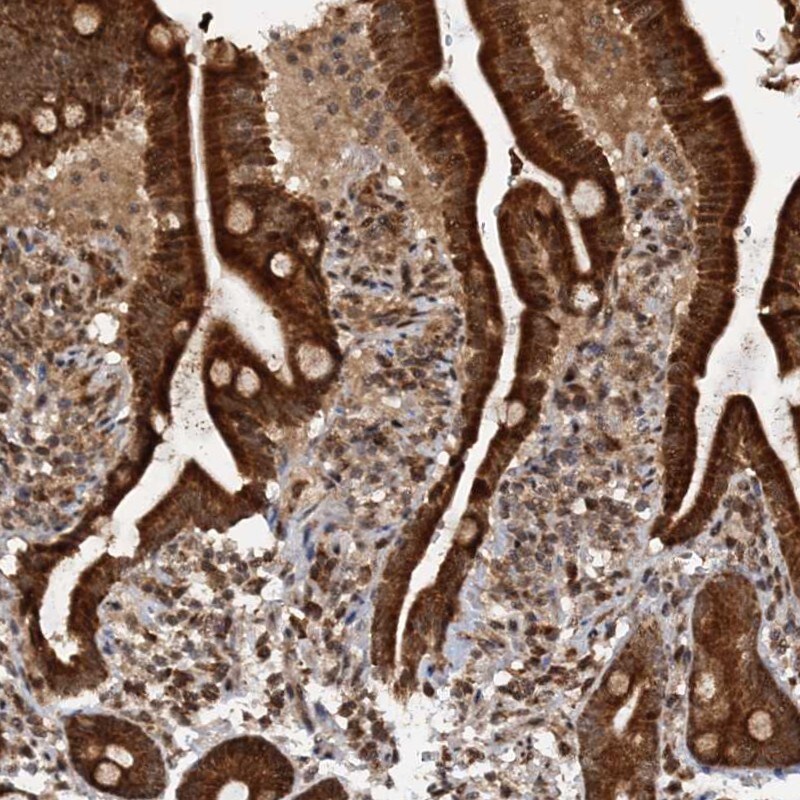 REP15 Antibody - BSA Free Immunohistochemistry: REP15 Antibody - BSA Free [NBP1-93441]