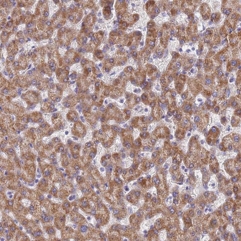 UQCRH Antibody - BSA Free Immunohistochemistry: UQCRH Antibody - BSA Free [NBP1-93442]