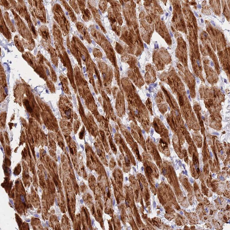 UQCRH Antibody - BSA Free Immunohistochemistry: UQCRH Antibody - BSA Free [NBP1-93442]