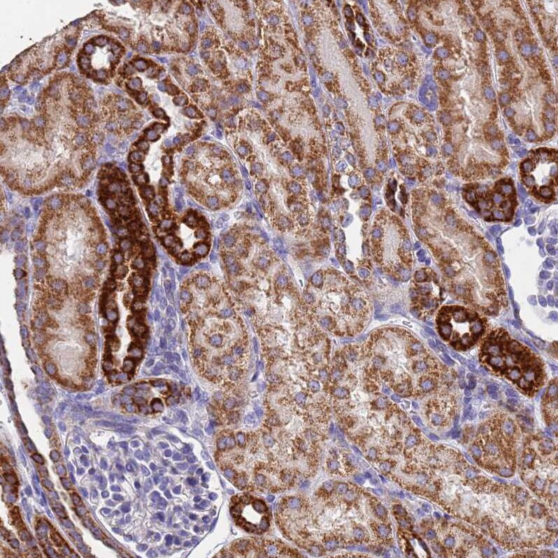 UQCRH Antibody - BSA Free Immunohistochemistry: UQCRH Antibody - BSA Free [NBP1-93442]