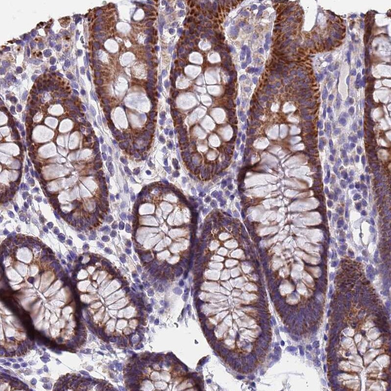 UQCRH Antibody - BSA Free Immunohistochemistry: UQCRH Antibody - BSA Free [NBP1-93442]