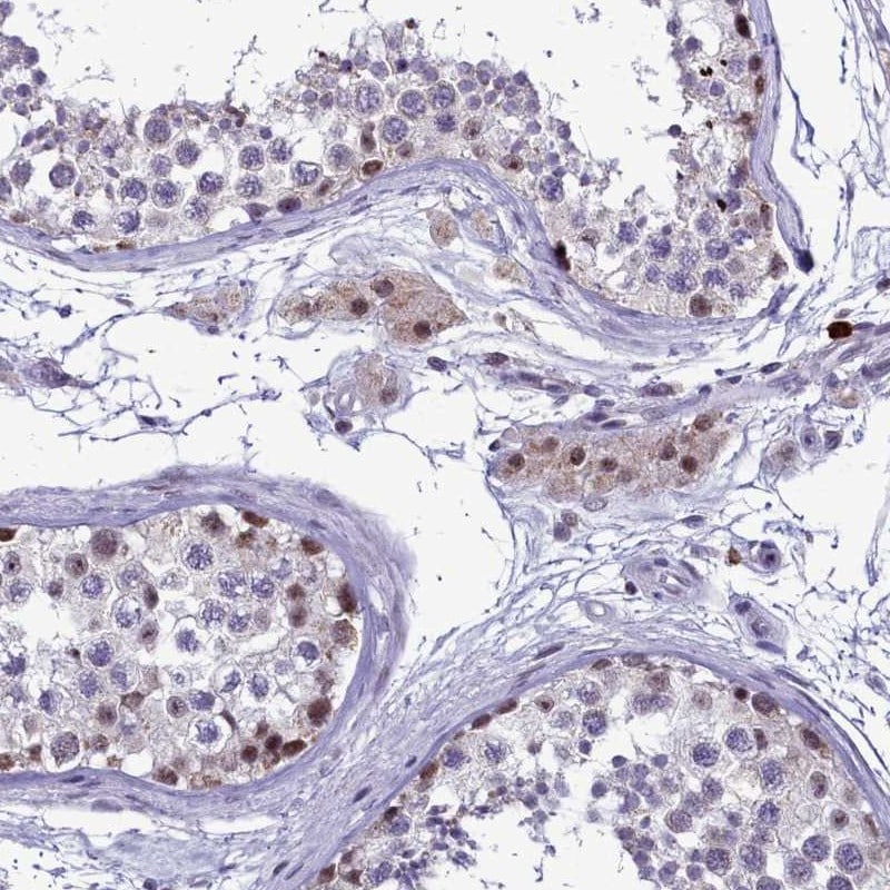 POM121L2 Antibody - BSA Free Immunohistochemistry: POM121L2 Antibody - BSA Free [NBP1-93443]