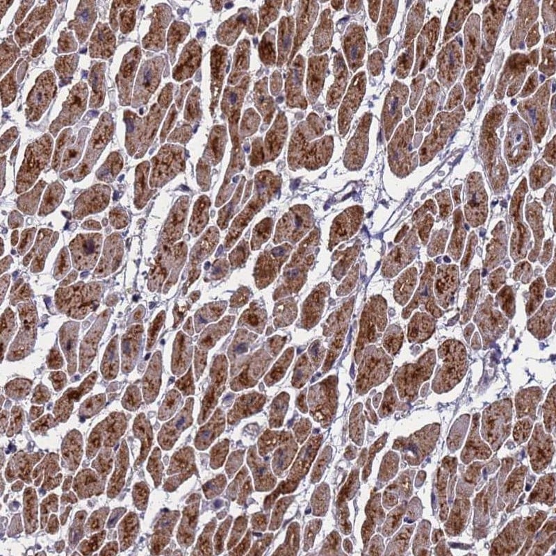 MTCP1NB Antibody - BSA Free Immunohistochemistry: MTCP1NB Antibody - BSA Free [NBP1-93450]