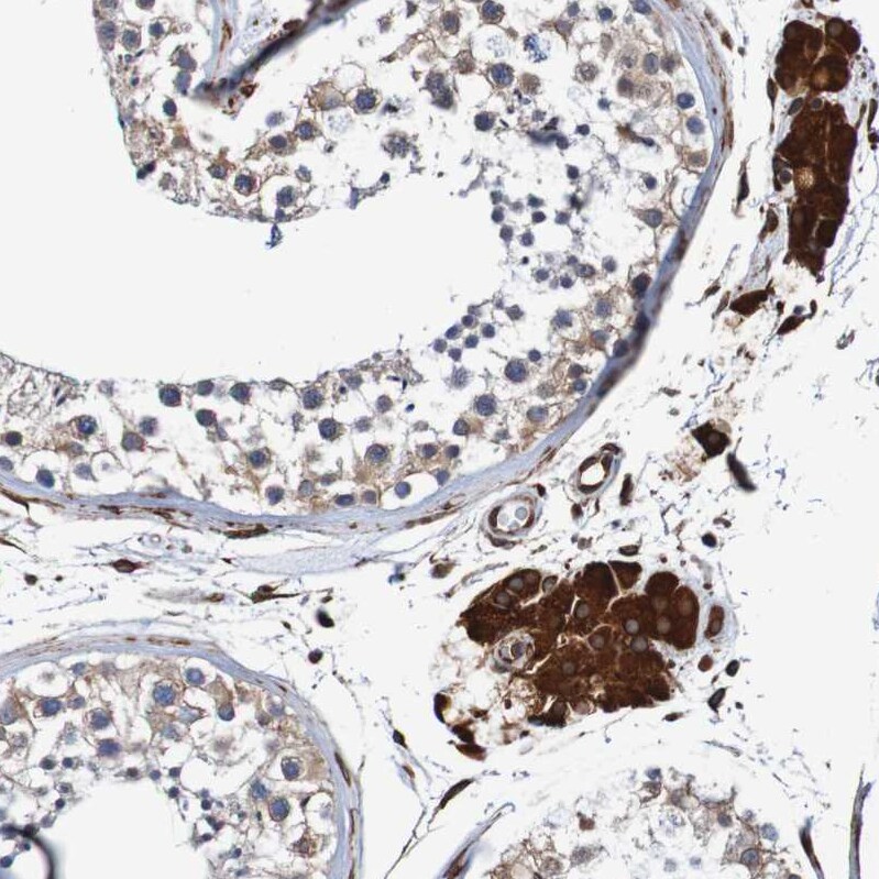 TMEM109 Antibody - BSA Free Immunohistochemistry: TMEM109 Antibody - BSA Free [NBP1-93462]