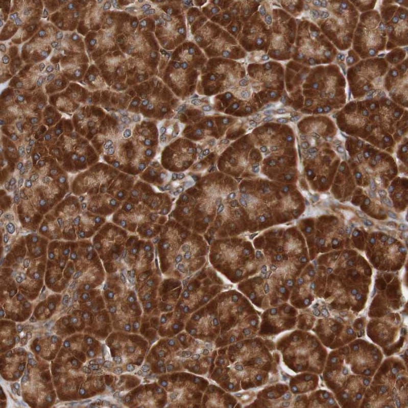 TMEM109 Antibody - BSA Free Immunohistochemistry: TMEM109 Antibody - BSA Free [NBP1-93462]